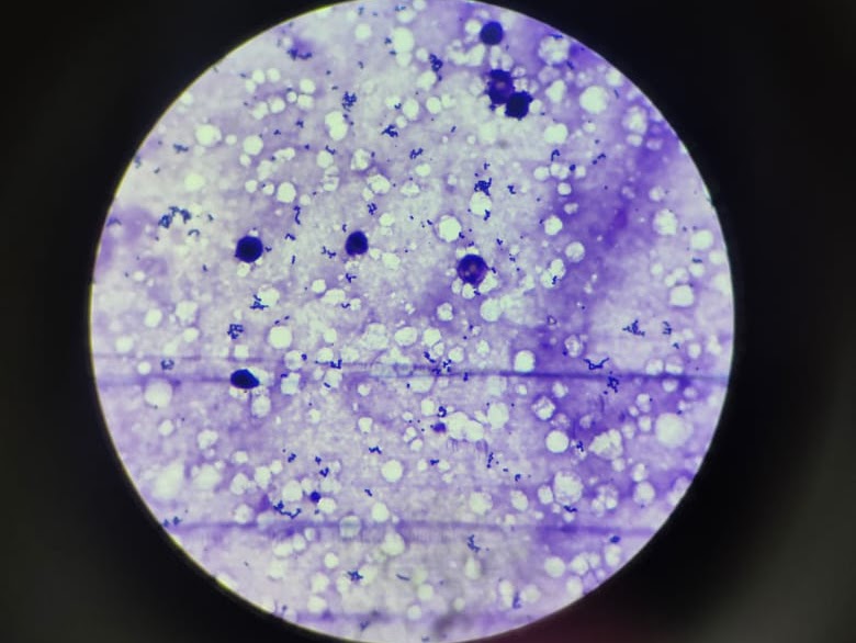 Microscope view: stained tissue + microbial cells under magnification